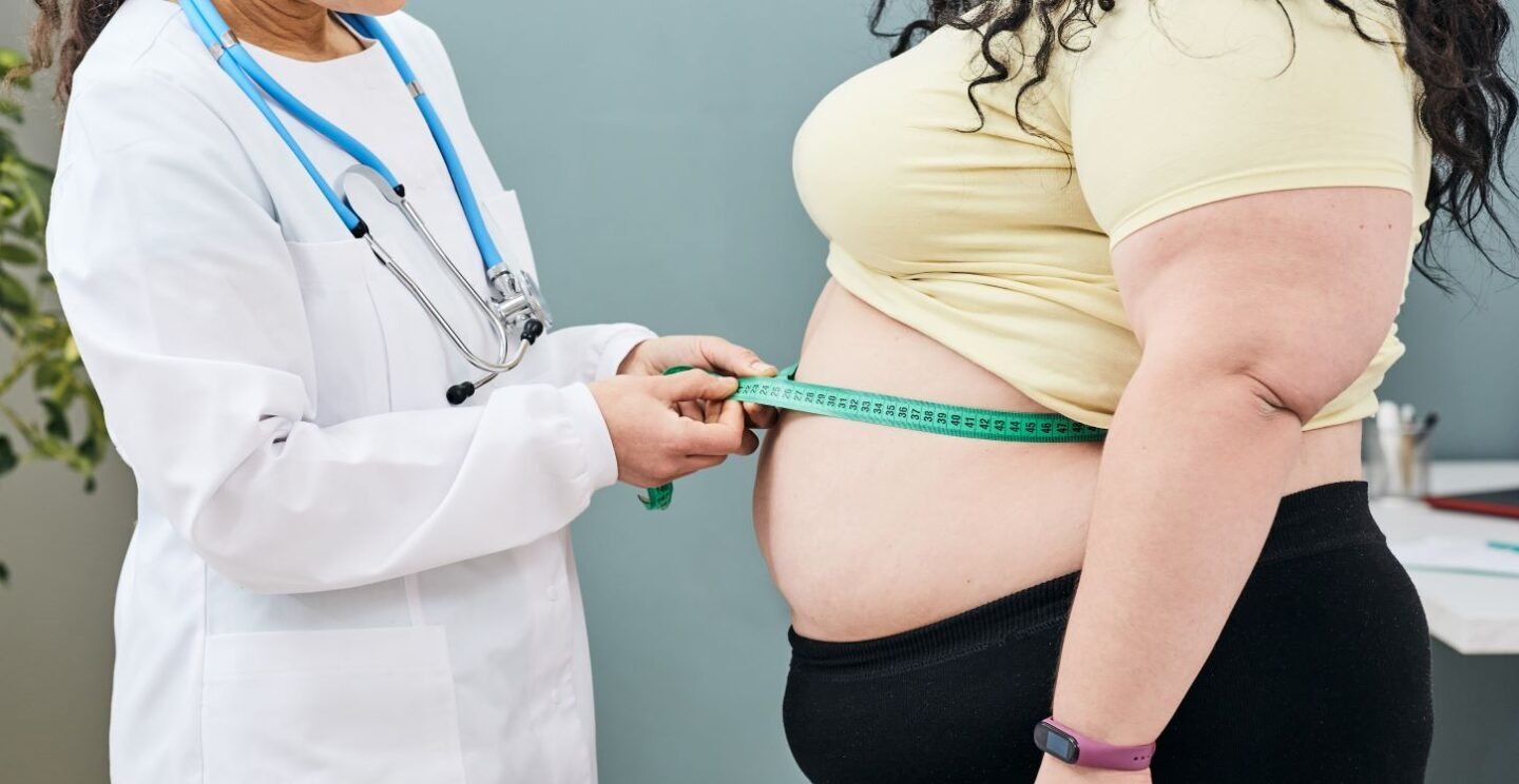 Un 68 % de dominicanos tiene índice de masa corporal alto, de ellos un 32 % con obesidad