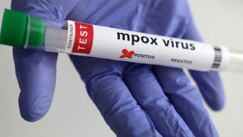 Identifican una nueva cepa de mpox en Inglaterra