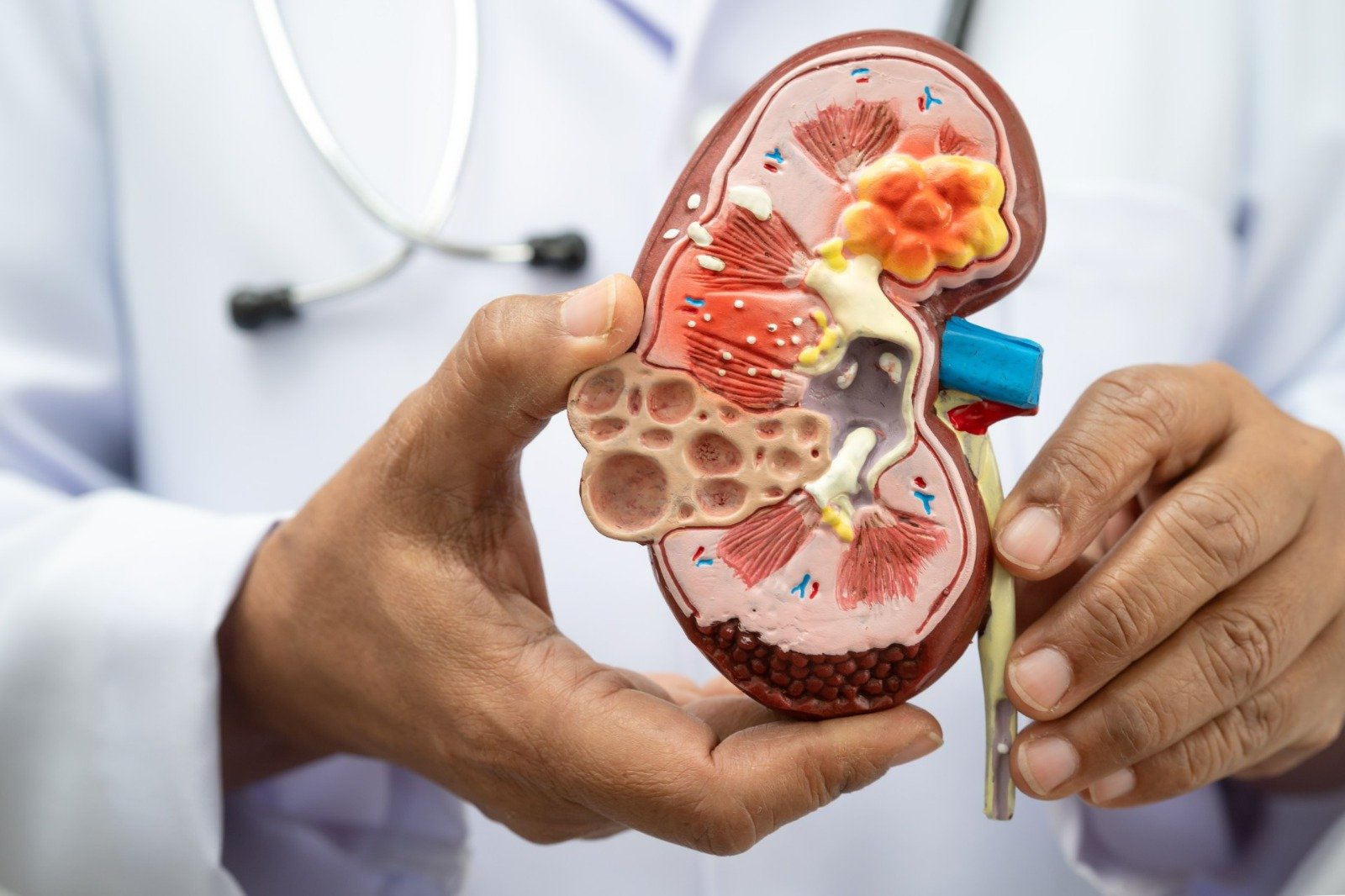 Nefróloga asegura que chequeos médicos son claves para proteger salud renal
